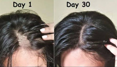 Hair Growth Derma Roller 0.5mm